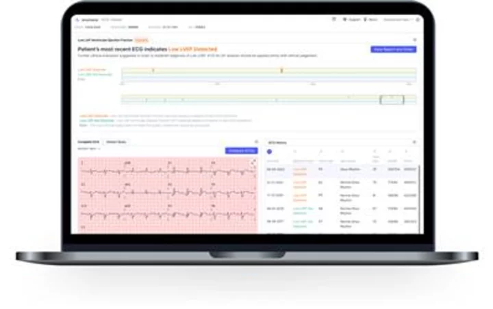 Anumana Receives U.S. FDA 510(k) Clearance for ECG-AI Algorithm to Detect Low Ejection Fraction