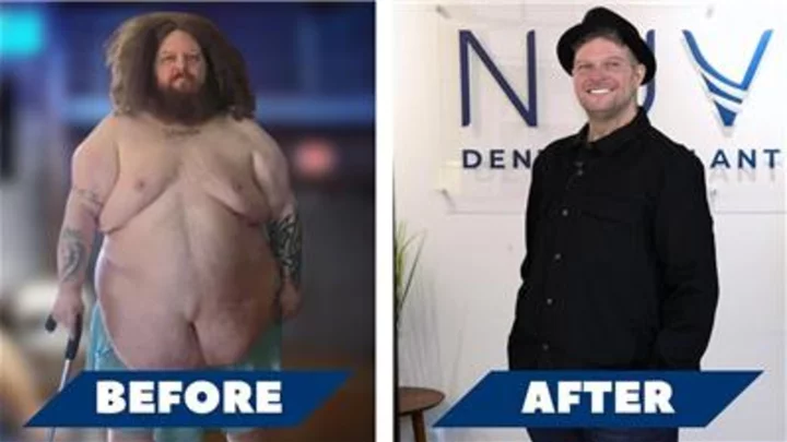 Inspiring Transformation: Man Loses 300 lbs, Gets Awarded Smile Makeover From Nuvia Dental Implant Center