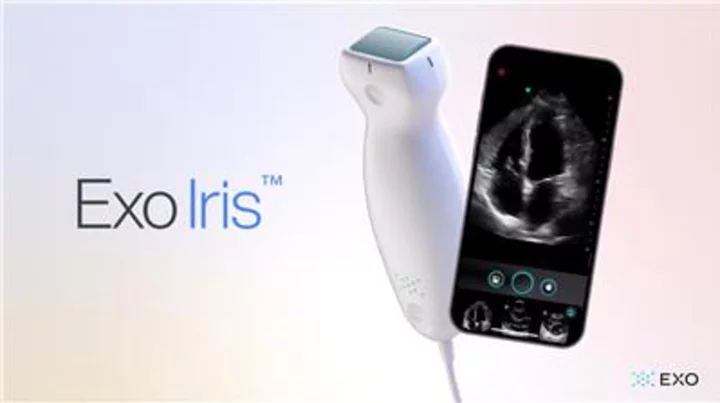 Exo® Introduces a New Age of Ultrasound with Exo Iris™
