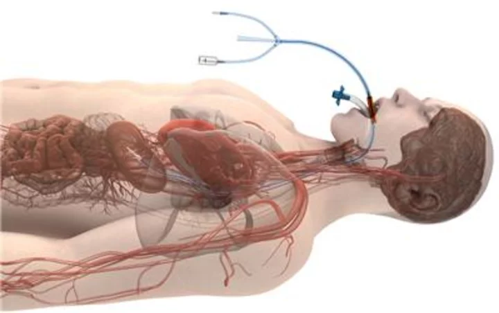 Study Finds Significant Reduction in Esophageal Injury Rate When Using ensoETM™ During Cardiac Radiofrequency Ablation Procedures