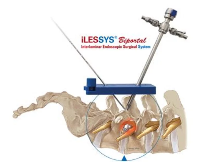 joimax® Launches New iLESSYS® Biportal Interlaminar Endoscopic Surgical System